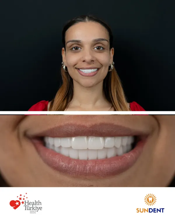 Before and After Treatment 15