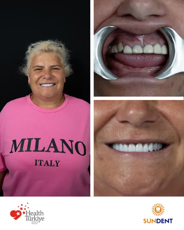 Before and After Treatment 6